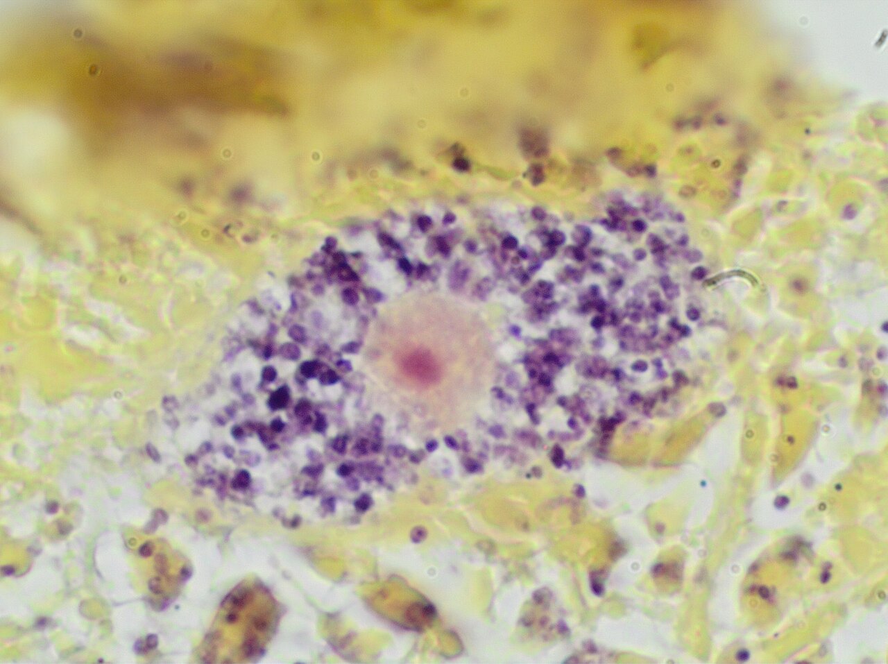 Macrophage